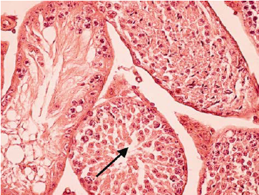 Image result for استروئید