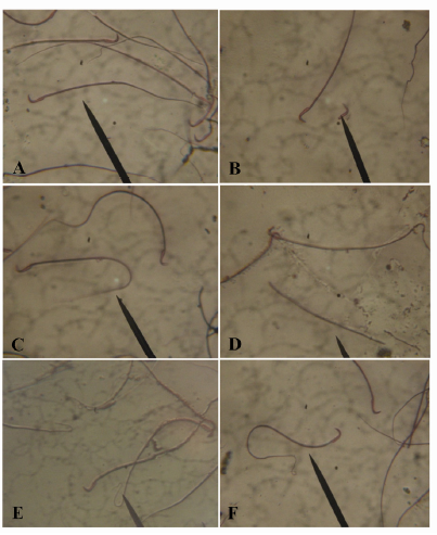 Be paid as a swinger Physical characteristics of rat sperm