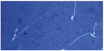 Women bdsm pony Eosin-nigrosin and viability of sperm interpretation
