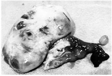 Figure 2. Adnexectomy specimen before follicular aspiration