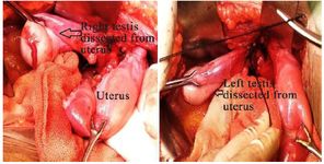 Figure 3. Intraoperative image showing dissected right and left testis from uterus
