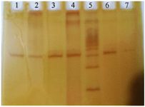 Figure 2. PCR PAGE GEL. Lane: 1, 2, 3, 4, 6-Amplified PCR products of exon-2, MED-12. Lane: 5-100 base pair DNA ladder. Lane 7-Negative control
