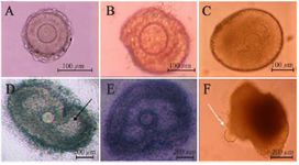 Figure 1. Images of mouse PFs during in vitro culture; PFs on the first day (A), 4th day (B), 6th day (C), 8th day (D), and 10th day (E) ovulated oocyte; white arrow (F) antrum cavity; black arrow