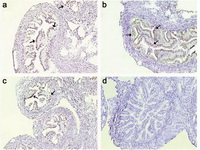 Figure 3. IDO immunostaining of fallopian tubes at different stages of murine pregnancy. IDO-positive cells were immunolocalized in fallopian tubes of syngeneic pregnant (Balb/c× Balb/c) mice at early (a), mid (b) and late (c) gestational periods. Fig. d: negative control slide.  Black arrows show IDO positive cells (Magnifica-tion: 200 ×).