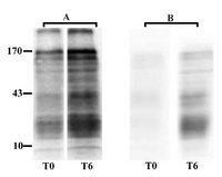 Figure 1. Western blotting of sperm tyrosine phosphorylated
proteins extracted immediately after washing
(T0) and after 6 h (T6) of incubation under capacitating
conditions. A: Normospermia; B: Teratospermia.