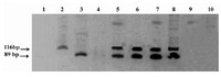 Figure 1. Nested PCR products for hupB gene resolved on 8% polyacrylamide gel
Lane 1: Negative control 
Lane 2: M. tuberculosis positive control	
Lane 3: M.  bovis positive control  
Lanes 4, 9 and 10: negative samples
Lanes 5, 6, 7 and 8: Dual infection with M. tuberculosis and M. bovis
