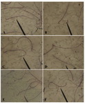 Figure 1. Photomicrograph showing sperm from the cauda epididymis of male albino rats; A: normal sperm from the control rats; B-F: sperm showing defects in morphology after nicotine treatment; B: tail less sperm; C: Curve tail; D: Headless sperm; E: looped tail; F: coiled tail (arrow) (eosin/ nigrosin Mag. X100)
