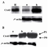 Figure 3. Effect of androstenedione on Cx43 expression. A. Western blot analysis of Cx43 protein in normal rat ovaries (lane a) and in androstenedione treated rats’ PCO ovaries (lane b). Lane H: heart sample Cx43 control. B. Western blot analysis of Cx43 protein in GCs on day 4 of culture. Cx43 proteins expressed in GCs cultured on EHS-drip (lane a), in the presence of l0-7 M (lane b) or l0-5 M (lane c) androstenedione. P0, unphosphorylated form of Cx43 protein, P1 phosphorylated active form of Cx43. β-actin protein shows for equal loading