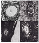 Figure 2. Atretic follicles belong to the ovary 63 days after BUAL bilateral uterine artery ligation. A: Normal follicle from the control-sham group; B: Atretic follicle (201-300 µm) form with GCs dissociation (Arrow) around the vacuolated oocyte (Arrow head); C: Atretic follicle (101200 µm) with pyknosis of the oocyte and D: Atretic follicle (301400 µm) with increased thickness of ZN (Arrow). H&E staining, (A: 600×, B: 400×, C: 100× and D: 400×)