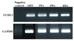Figure 2. RT-PCR representation for spermatogonial stem cell marker UCHL1 in adult human testis (AHT) tissue and throughout the entire culture. GAPDH was used for cell presence