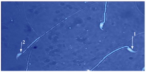Figure 2. EP group: sperm head with mature nuclei is light blue; 1: and sperm head containing immature nuclear chromatin is dark blue; 2: (Aniline blue ×1000)