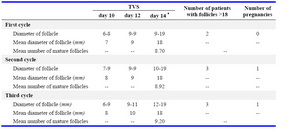 Table 3. Folliculometry in three cycles of tamoxifen group in CC resistant PCOS women

TVS: Transvaginal Ultrasonography
* Day of  hCG  injection
