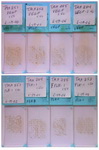 Figure 1. Examples of tissue microarray slides immunostained with VEGF and Flk-1 antibodies