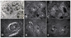 Figure 5. The electron micrograph of granulosa cells of secondary follicles from control or non-frozen (Ax4795), DCV1 (Bx2784) and DCV2 (Cx3597) DCV5 (Dx3597), DCV6 (Ex2156) and DCV7 (Fx2784). The granulosa cells in single cryoprotectant appeared to have cytoplasmic retraction with nuclear shrinkage (A, B). In DCV5 and DCV6 groups were some perinuclear space (D, E). Granulosa cells were well preserved in non-frozen and DCV 7 groups (A, F). N: nucleus, PS: perinuclear space