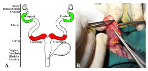 Figure 1. A) Schematic illustration of the rabbit uteri. Red marks show incision and curettage sites of the two uteri and green marks show the control sampled sites. B) Surgical procedure of intrauterine curettage of the right rabbit uterus using a scalpel