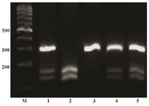 Figure 1. PCR-based restriction analysis of the +49 A/G polymorphism was shown on 2% agarose electrophoresis. The polymorphic region was amplified by PCR resulting in a 289 bp fragment (AA wild type homozygote) in line 3 after size marker. Digestible fragments, 159 and 130 bp, represent the GG mutant homozygote (line 2). The presence of three bands 289, 159 and 130 which belong to heterozygote individuals (line 1, 4 and 5). M: mar