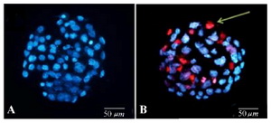 Figure 2. Mouse blastocysts on day 5 of development. A) In control group, no necrotic cell was observed using excitation wavelength (350-461 nm) which confirmed that all the cells of the stained blastocyst were alive. B) Experimental blastocyst with major irregularities in size, color and density of individual cells under fluorescence microscopy with excitation wavelength (535-617 nm). Red blastomeres show necrotic cells (green line) (200x)