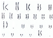 Figure 2. Cytogenetic analysis of female proband