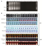 Figure 2. A: Gel electrophoresis pattern of LAMP amplicons on 1.5% agarose gel; B: Details of eight different visualization methods to analyze LAMP products. Lane M: DNA size marker (100 bp), lanes and tubes 1-7: positive samples, lanes and tubes 8-15: negative samples, lane and tube N: non-preg-nant women sample (negative sample) and, lane and tube P: men sample (positive control)
