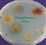 Figure 3. Formation of inhibitory zone of Staphylococcus aureus (ATCC29213) around amniotic tissue
