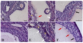 Figure 1. Effect of different hormonal treatment on the percentage of follicles presenting atretic/cystic signs.
Descriptive images of peculiar morphological changes in antral follicle walls of ovaries isolated from controls (A, D) compared to DHEA-treated mice (B, C, E, F), stained with haematoxylin and eosin. In the control (A, D), theca externa, theca interna, basal membrane and granulosa cells layers appear normal. Cystic features are described by presence of spherical piknotic nuclei (B), loss of mural granulosa cells architecture (B and E, white arrows), depletion of basal membrane (B and E, asterisks), macrophages in the cystic fluid (B and F, red arrows), thin and elongated epithelioid cells in the inner surface of the wall (C and F, black arrows) and reduction of granulosa cells layers (C). Bars=50 &micro;m