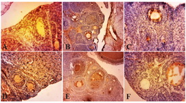 Figure 2. Photo micrographs of immunohistochemical ex-pression of TNF-&alpha; in the primary and secondary follicles. (A) normal ovary; (B) strict expression of TNF-&alpha; is observable in these follicles in PCOS group; (C, D, E, F) TNF-&alpha; expression is restricted to blood vessels and ovary stroma (filled arrow) in curcumin groups (100, 200, 300, 400 mg/kg BW). Mag-nification &times;100 , (Scale bar, 25 &mu;m)
