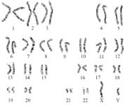 Figure 1. Karyotype image showing normal 46,XY chromosome spread in SCOS case