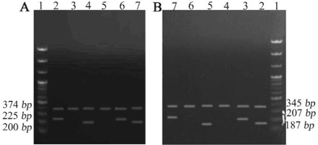 Figure 1. Electrophoresis of tetra-ARMS PCR products to determine the genotype of rs1484215 and rs6495096 in CYP11A1 gene. A: (rs6495096): Lane 1: DNA ladder (100 bp); Lane 2 and 3: homozygous genotype (GG); Lane 4 and 5: homozygous genotype (CC); La