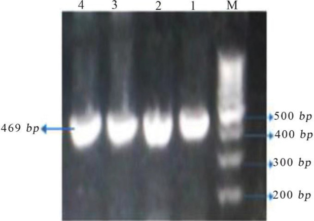 Figure 1. Agarose gel electrophoresis stained by safe stain after PCR amplification of VEGFR1. “M” represents “Marker”. The size of PCR product was 469 bp