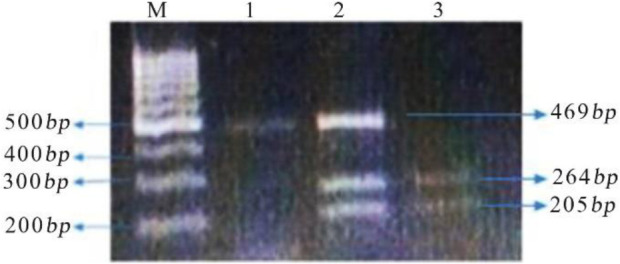 Figure 2. PCR-RFLP products. M=Molecular marker, TT= 469 bp (lane 1), TC=205, 264, 469 bp (lane 2), and CC=205 and 264 bp (lane 3)
