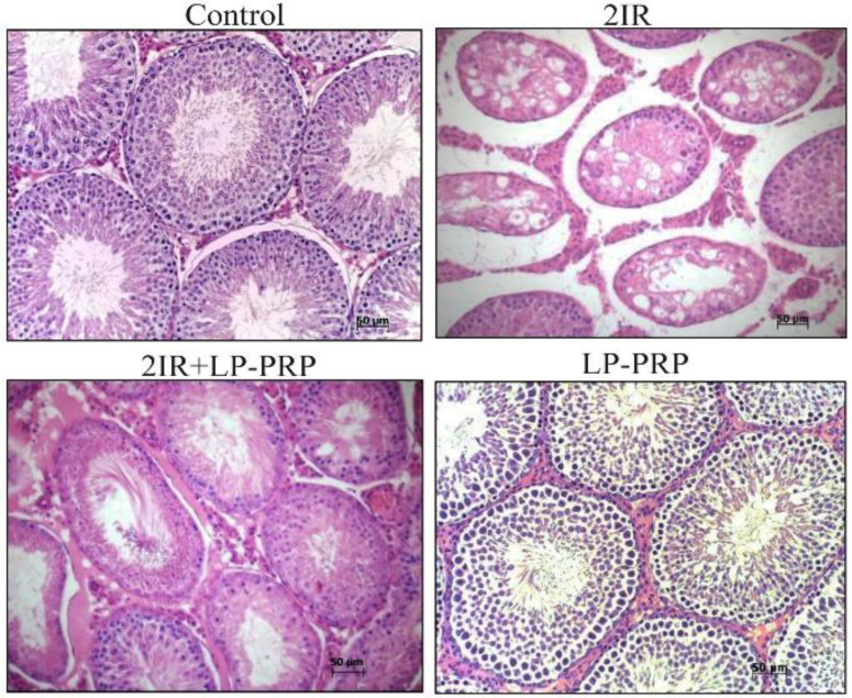 Figure 1. Morphological study of the testes at the 12th week of the experiment in the groups of control, irradiation (2IR), irradiation+LP-PRP (2IR+LP-PRP), and LP-PRP. Hematoxylin and eosin stain, magnification ×200