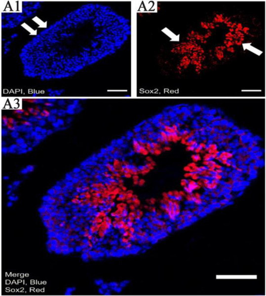 Figure 3. The pattern of Sox2 expression by confocal scanning UV-laser microscope. A1) the DAPI (blue for 4′, 6-diamidino-2-phenylindole) staining shows the nuclear cells, A2) the expression of Sox2 in seminiferous tubules, and A3) Merged images (sca