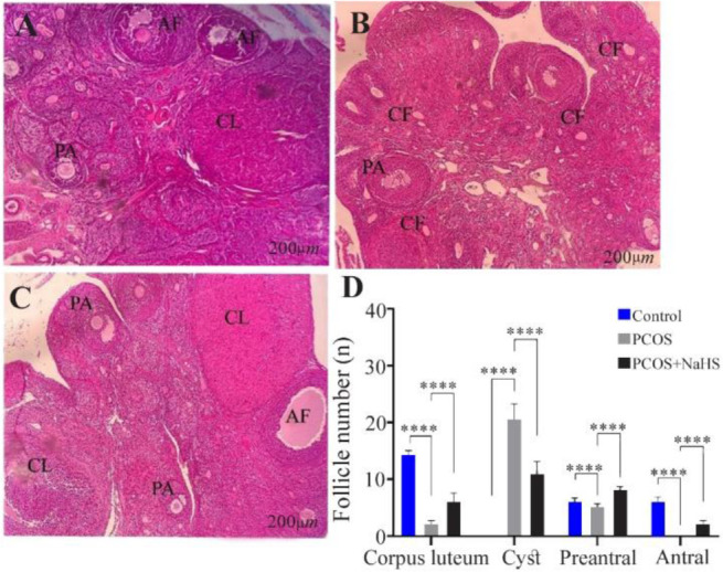 Figure 4 Changes in ovarian histology in different groups depicted with hematoxylin and eosin staining using light microscopy (n=3). A) control, B) PCOS, C) PCOS+ NaSH group. In the control group (A), there was no detectable damage to the ovarian tis