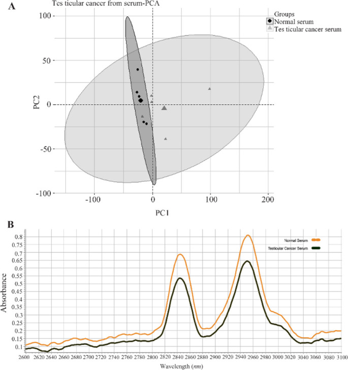 Figure 1 A) Results of principal component analysis (PCA) of the data matrix from the serum of testicular cancer (CS) patients (--▲--) versus healthy men (NS) (--◼--) as control group. B) Average Raman spectra for serum of testicular cancer (―) patie