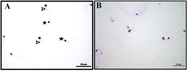 Figure 1. Diff-quick staings. Sperm cells with double tail anomaly (white arrowhead) and sperm cells with round head anomaly (star) belonging to the OAS group stained with diff-quick dye are shown (A). Sperm cells (white arrowhead) belonging to the N