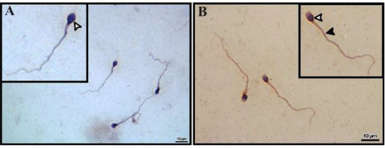 Figure 5. NOX5 immunohistochemical staining in sperm. A) White arrow head shows sperm plasma staining in NS. B) Plasma membrane (white arrow) and tail (black arrow) NOX5 staining in OAS. Bar=10 μm