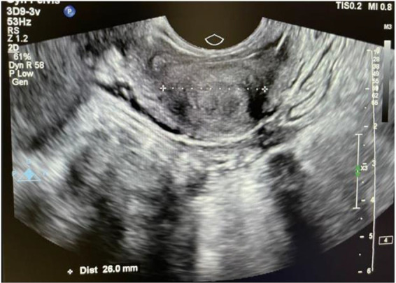 Figure 1. Transverse view