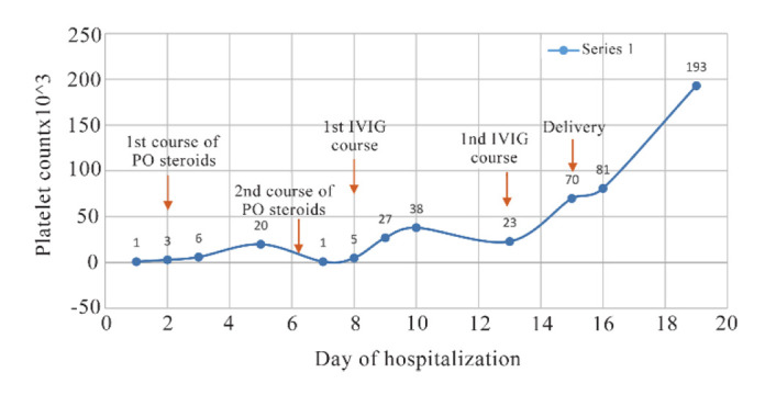 Figure 2 The platelet counts during the patient’s hospital stay shown as days of hospitalization. The platelet count increased from 1000/mm3 on the day of admission to 70,000/mm3 on the day of delivery. This rise in platelet count was the result of s