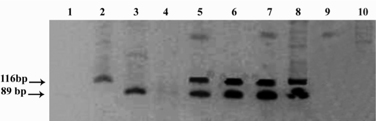 Figure 1 Nested PCR products for hupB gene resolved on 8% polyacrylamide gel Lane 1: Negative control Lane 2: M. tuberculosis positive control Lane 3: M. bovis positive control Lanes 4, 9 and 10: negative samples Lanes 5, 6, 7 and 8: Dual infection w