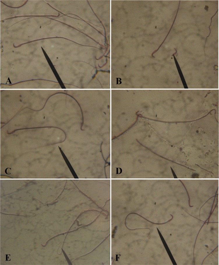 Figure 1 Photomicrograph showing sperm from the cauda epididymis of male albino rats; A: normal sperm from the control rats; B-F: sperm showing defects in morphology after nicotine treatment; B: tail less sperm; C: Curve tail; D: Headless sperm; E: l