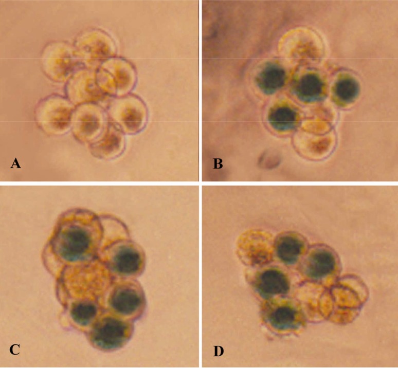 Figure 1 Expression of LacZ on the siRNA transfected mouse embryos. A) Embryos without zona pellucida cultured to 8-cell stage without virus infection; B-D) Adenoviral infection group, LacZ expression blastomeres stained blue)