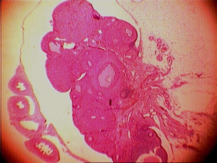 Figure 2 The ovary. In the ovarian tissue, the cysts were mainly disappeared by Chamomile administration.