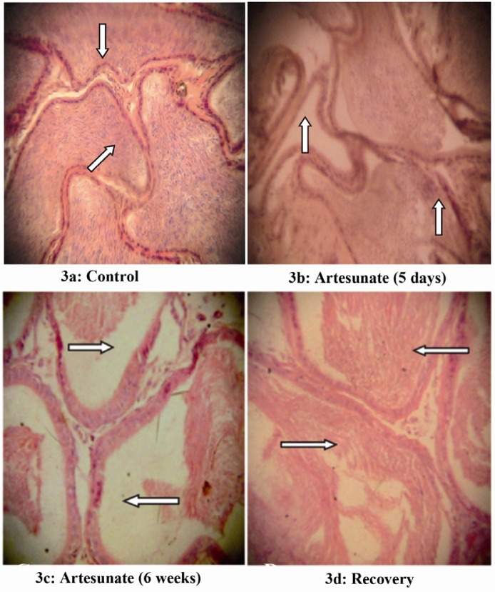 Figure 3 Effects of artesunate administration on the histology of rat epididymis. (3a): Control, (3b): Artesunate (5 days), (3c) Artesunate (6 weeks) and (3d) Recovery. (Arrows showing stored sperm cells; Mag. x 100)