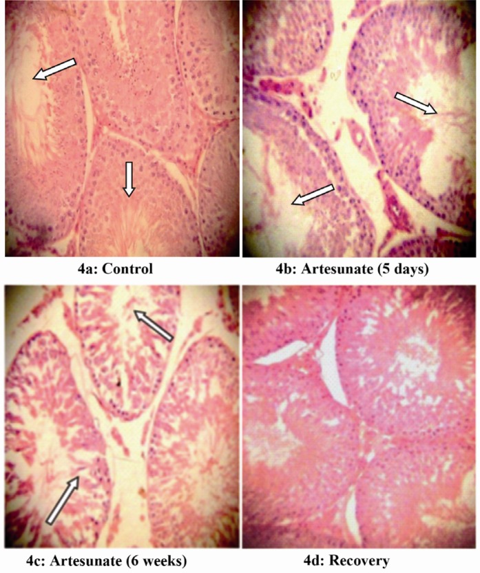 Figure 4 Effects of artesunate administration on the histology of rat testis. (4a): Control, (4b): Artesunate (5 days), (4c): Artesunate (6 weeks) and (4d) Recovery. (Arrows showing somniferous tubules; Mag. x 100)