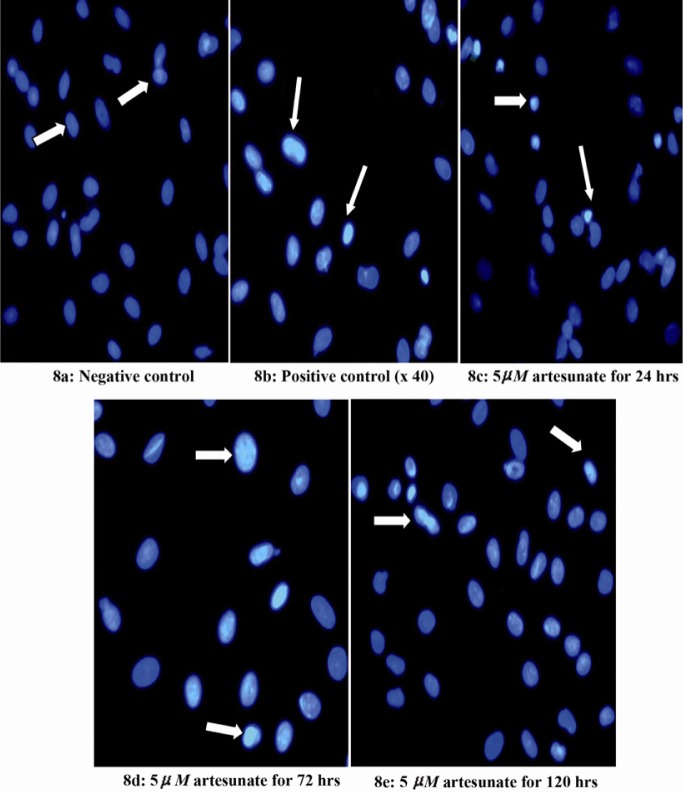 Figure 8 Effects of 5 μM artesunate on ds-DNA integrity of Sertoli cells. (8a) Negative control (untreated) (8b) Positive control (N-9 treated) (8c) 5 μM of artesunate for 24 hours (8d) 5 μM of artesunate for 72 hours (8e) 5 μM of artesunate for 120