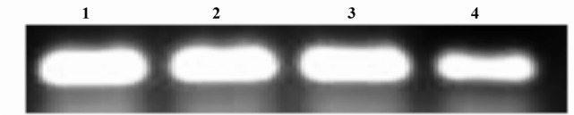 Figure 10 GDNF gene expression in cultured Sertoli cells. 1=Artesunate (5 μM); 2=Artesunate (2.5 μM); 3= Artesunate (1.25 μM); 4=Control