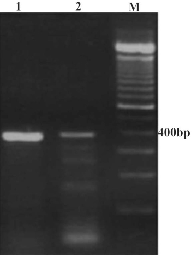 Figure 2 PvuII digestion of the human ∼3kb PCR product. This enzyme recognizes a CAG CTG sequence in human PERF15 gene and cuts this gene into 2 fragments of 1159bp and 1934bp. Lane 1: undigested human PCR product amplified with hP1/hP2. Lane 2) the