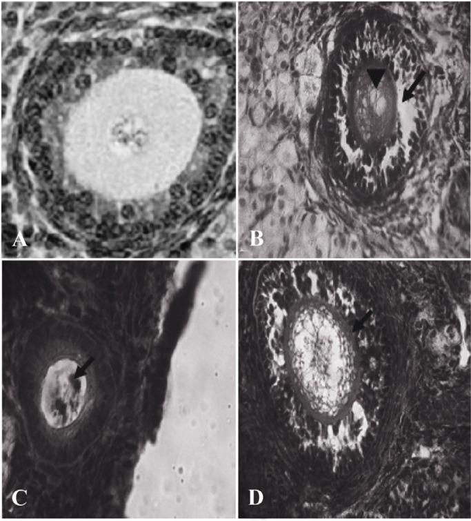 Figure 2 Atretic follicles belong to the ovary 63 days after BUAL bilateral uterine artery ligation. A: Normal follicle from the control-sham group; B: Atretic follicle (201-300 µm) form with GCs dissociation (Arrow) around the vacuolated oocyte (Arr