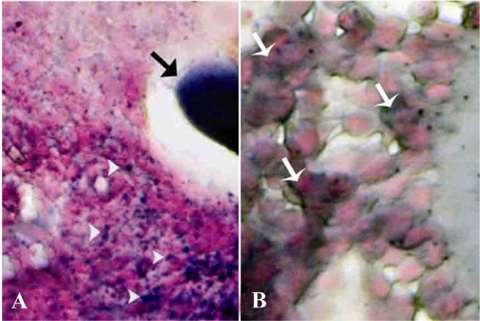 Figure 4 Cross-section from ovary 63 days after bilateral uterine artery liagtion, A: An early atretic follicle; note dense lipidophilic reaction of the oocyte (arrow) and lipid positive ovarian interstitial cells (arrow heads); B: showing intensely 