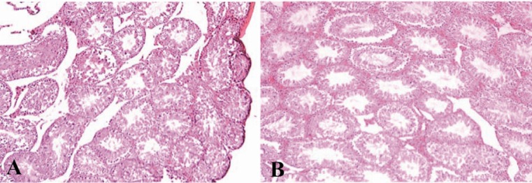 Figure 1 Photomicrographs of mice testis tissue in mice in the treated groups received methylphenidate; A: and the control group; B: (H&E×40)